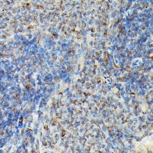 Immunohistochemistry analysis of paraffin-embedded rat spleen using Anti-VASP (phospho Ser239) Antibody (A12464) at a dilution of 1:100 (40x lens) Perform high pressure antigen retrieval with 10 mM citrate buffer pH 60 before commencing with IHC staining protocol