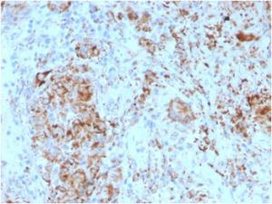 Immunohistochemical analysis of formalin-fixed, paraffin-embedded human lymph node tissue using Anti-TIM3 Antibody [TIM3/4024]