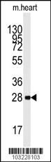 Anti-PRKAB1 Rabbit Polyclonal Antibody