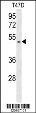 Anti-BABAM1 Rabbit Polyclonal Antibody