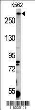 Anti-Pericentriolar Material 1 Protein Rabbit Polyclonal Antibody (AP (Alkaline Phosphatase))