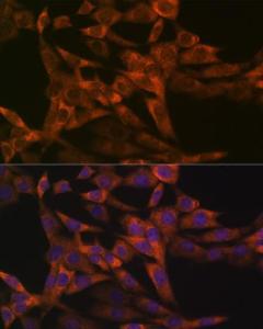 Immunofluorescence analysis of NIH-3T3 cells using Anti-IRF6 Antibody [ARC1928] (A308141) at a dilution of 1:100 (40X lens). DAPI was used to stain the cell nuclei (blue)