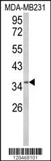 Anti-BABAM1 Rabbit Polyclonal Antibody