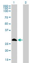 Anti-FHL1 Mouse Monoclonal Antibody [clone: 2A9]