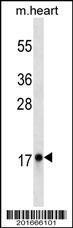 Anti-MB Mouse Monoclonal Antibody [clone: 444CT19.2.1]