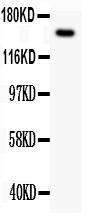 Anti-C-MET/HGFR Polyclonal Antibody