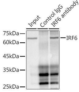 Immunoprecipitation analysis of 300 µg extracts of HepG2 cells using 3 µg of Anti-IRF6 Antibody [ARC1928] (A308141). This Western blot was performed on the immunoprecipitate using Anti-IRF6 Antibody [ARC1928] (A308141) at a dilution of 1:1000