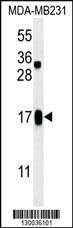 Anti-SMIM14 Rabbit Polyclonal Antibody