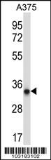 Anti-PRKAB2 Rabbit Polyclonal Antibody