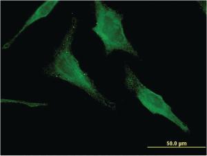 Anti-HEXA Mouse Monoclonal Antibody [clone: 3D1]