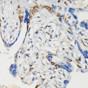 Immunohistochemistry analysis of paraffin-embedded human placenta using Anti-VASP (phospho Ser239) Antibody (A12464) at a dilution of 1:100 (40x lens) Perform high pressure antigen retrieval with 10 mM citrate buffer pH 60 before commencing with IHC staining protocol