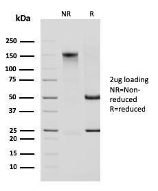 SDS-PAGE analysis of Anti-Cytokeratin 14 Antibody [KRT14/2375] under non-reduced and reduced conditions; showing intact IgG and intact heavy and light chains, respectively. SDS-PAGE analysis confirms the integrity and purity of the antibody.