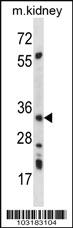 Anti-PRKAB2 Rabbit Polyclonal Antibody