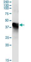 Anti-MAT1A Mouse Monoclonal Antibody