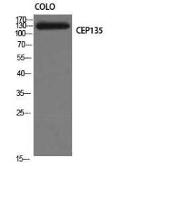 Antibody anti-CEP135 100 µg