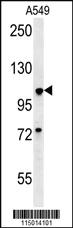 Anti-BUB1A Rabbit Polyclonal Antibody