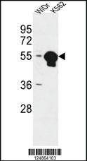 Anti-ATP6V1B1 Rabbit Polyclonal Antibody