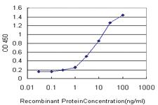 Anti-FHL1 Mouse Monoclonal Antibody [clone: 2A9]