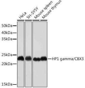 Anti-HP1 gamma / CBX3 Rabbit Monoclonal Antibody [clone: ARC0952]