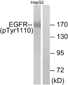 Western blot analysis of lysates from HepG2 cells using Anti-EGFR (phospho Tyr1110) Antibody. The right hand lane represents a negative control, where the antibody is blocked by the immunising peptide.