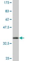 Anti-CRYGC Mouse Monoclonal Antibody [clone: 7C4]