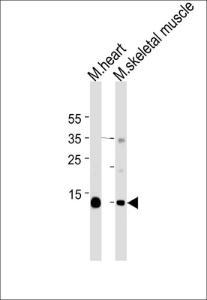 Anti-MB Mouse Monoclonal Antibody (AP (Alkaline Phosphatase)) [clone: 444CT19.2.1]