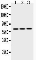 Anti-EPHX2 Rabbit Polyclonal Antibody