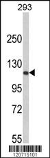 Anti-RB1 Rabbit Polyclonal Antibody