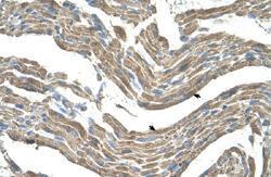 Anti-ASPN Rabbit Polyclonal Antibody