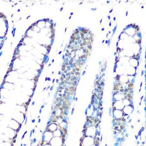 Anti-HP1 gamma / CBX3 Rabbit Monoclonal Antibody [clone: ARC0952]