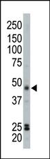 Anti-PKA C-beta (PRKACB) Rabbit Polyclonal Antibody