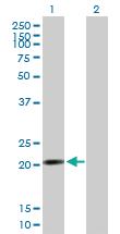 Anti-RP13-383K5.2 Mouse Polyclonal Antibody