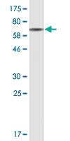 Anti-BKPyVgp4 Mouse Monoclonal Antibody [clone: 5E6]