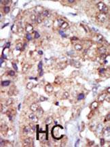 Anti-LYN Rabbit Polyclonal Antibody