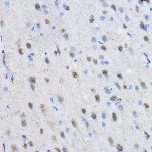 Immunohistochemistry analysis of paraffin-embedded rat brain using Anti-HP1 gamma / CBX3 (methyl His175) Antibody (A307038) at a dilution of 1:50 (40x lens). Perform high pressure antigen retrieval with 10 mM citrate buffer pH 6.0 before commencing with IHC staining protocol.