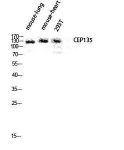 Antibody anti-CEP135 100 µg