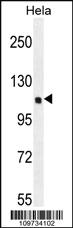 Anti-SIK3 Rabbit Polyclonal Antibody