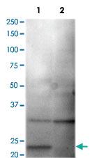 Anti-CLDN1 Rabbit Polyclonal Antibody