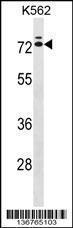 Anti-IL23R Rabbit Polyclonal Antibody (AP (Alkaline Phosphatase))