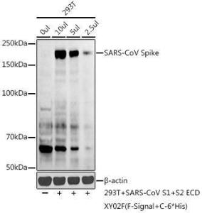 Western blot analysis of extracts of various cell lines, using Anti-SARS-CoV spike glycoprotein Antibody (A305663) at 1:1,000 dilution