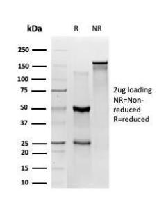 Anti-ZBED1 antibody