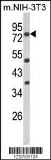 Anti-PRKCA Rabbit Polyclonal Antibody