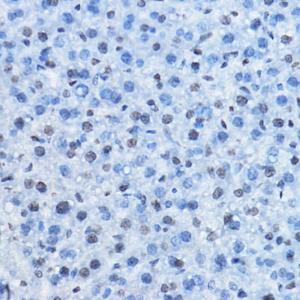 Immunohistochemistry analysis of paraffin-embedded mouse liver using Anti-HP1 gamma / CBX3 (methyl His175) Antibody (A307038) at a dilution of 1:50 (40x lens). Perform high pressure antigen retrieval with 10 mM citrate buffer pH 6.0 before commencing with IHC staining protocol.