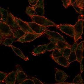 Immunofluorescent analysis of PFA-fixed HeLa cells stained with Anti-SOX4 Antibody [PCRP-SOX4-1D6] followed by Goat Anti-Mouse IgG (CF&#174; 488) (Green) CF&#174; 640A Phalloidin (Red)