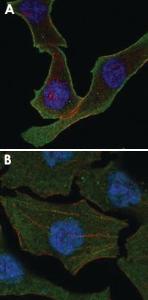 Anti-CALR Mouse Monoclonal Antibody [clone: 1G6A7]