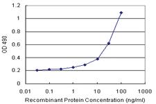 Anti-IGF2BP2 Polyclonal Antibody Pair