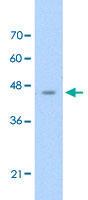 Anti-ASS1 Rabbit Polyclonal Antibody