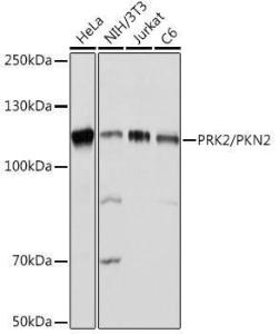 Western blot analysis of extracts of various cell lines, using Anti-PKN2 Antibody [ARC2274] (A307039) at 1:1,000 dilution