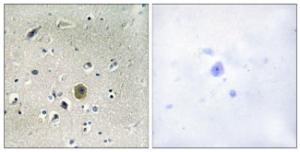 Antibody anti-MEK1 A96161-100 100 µg