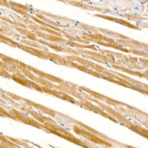 Immunohistochemistry analysis of paraffin-embedded mouse heart using Anti-PD-L2 Antibody [ARC60190] (A309669) at a dilution of 1:100 (40X lens). Perform high pressure antigen retrieval with 10 mM citrate buffer pH 6.0 before commencing with IHC staining protocol